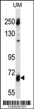 GGT7 Antibody (N-term)
