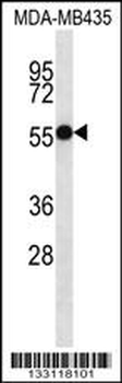 ASB4 Antibody (C-term)