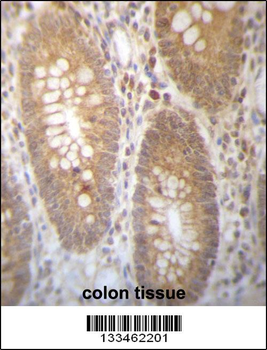 DHRS7B Antibody (Center)