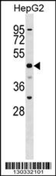 SLC2A9 Antibody (N-term)