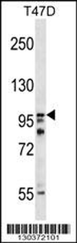 HPS3 Antibody (N-term)
