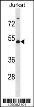 WTAP Antibody (C-term)