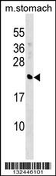 CRYBA4 Antibody (C-term)