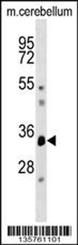 DUSP12 Antibody (Center)