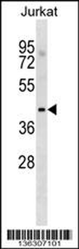 MGAT1 Antibody (Center)