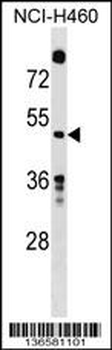 GDA Antibody (Center)
