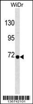 RPN1 Antibody (C-term)