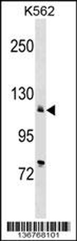 ATP2A2 Antibody (Center)