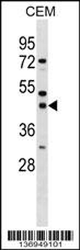 SSBP3 Antibody (Center)