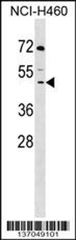 DCPS Antibody (Center)