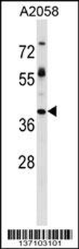 TPBG Antibody (Center)