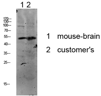 p53 Polyclonal Antibody