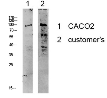 Kv2.1/KCNB1 Polyclonal Antibody