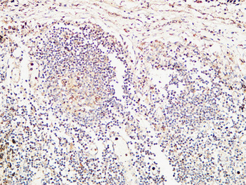 TIE2 Polyclonal Antibody