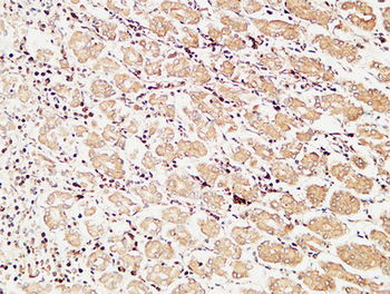TIE2 Polyclonal Antibody