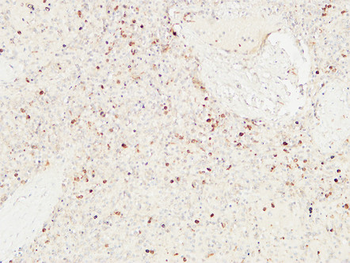 CD22 Polyclonal Antibody