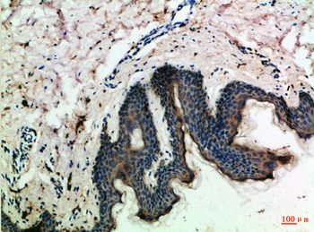MCP-3 Polyclonal Antibody
