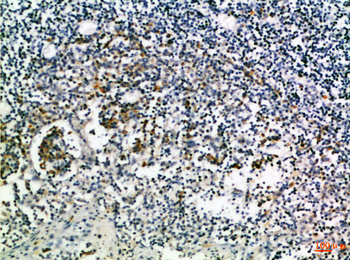 CD274 Polyclonal Antibody