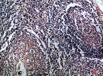 CD1A/B Polyclonal Antibody