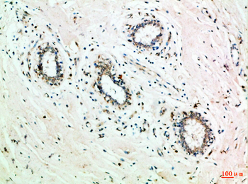 GRB7 Polyclonal Antibody