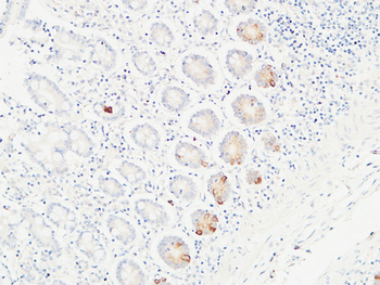 Ob Polyclonal Antibody