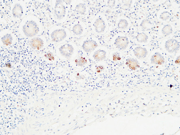 Ob Polyclonal Antibody
