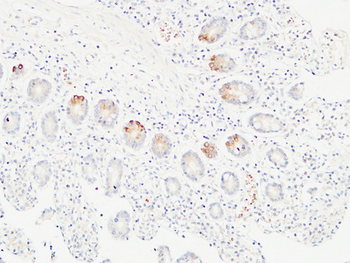Ob Polyclonal Antibody