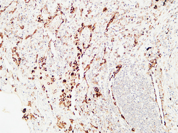 Napsin A Polyclonal Antibody
