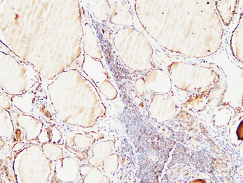 Thyroglobulin Polyclonal Antibody