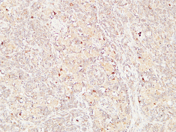 Thyroglobulin Polyclonal Antibody