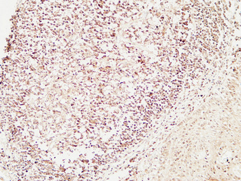 Bob 1 Polyclonal Antibody