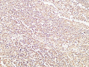 HDGF Polyclonal Antibody