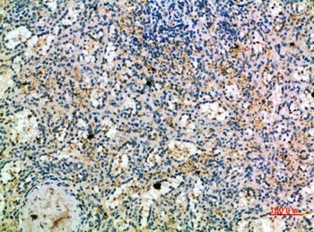 CKR-1 Polyclonal Antibody