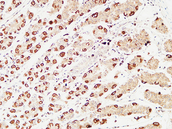 pS2 Polyclonal Antibody