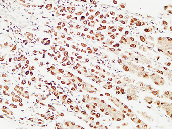 pS2 Polyclonal Antibody