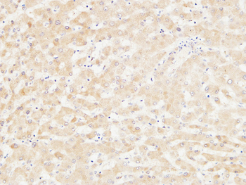 ANG I Polyclonal Antibody