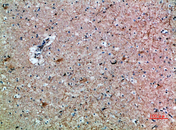 FSHβ Polyclonal Antibody