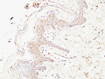 EGF Polyclonal Antibody
