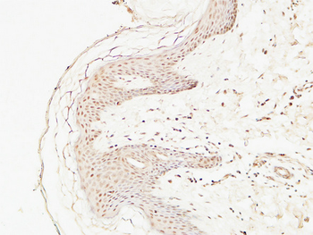 EGF Polyclonal Antibody