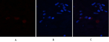 Annexin I Polyclonal Antibody