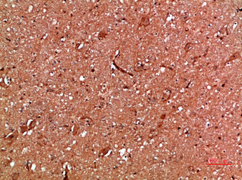 Annexin I Polyclonal Antibody