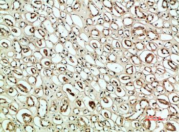 PLK2 Polyclonal Antibody