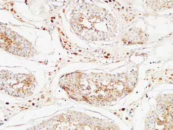 MIB1 Polyclonal Antibody