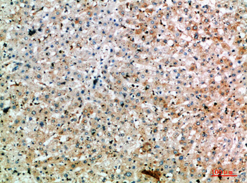 SPOP Polyclonal Antibody