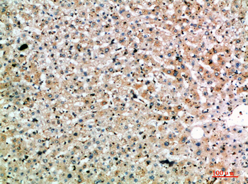 SPOP Polyclonal Antibody