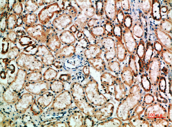 TyrRS Polyclonal Antibody