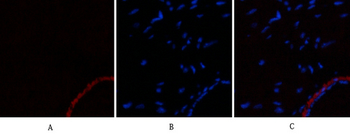 α-SMA Polyclonal Antibody