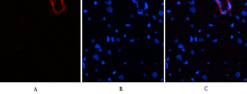 α-SMA Polyclonal Antibody