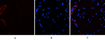 α-SMA Polyclonal Antibody