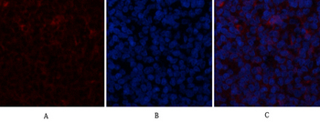 α-SMA Polyclonal Antibody